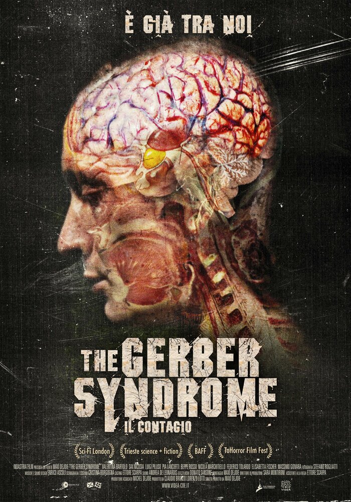 Синдром Гербера (2011) постер